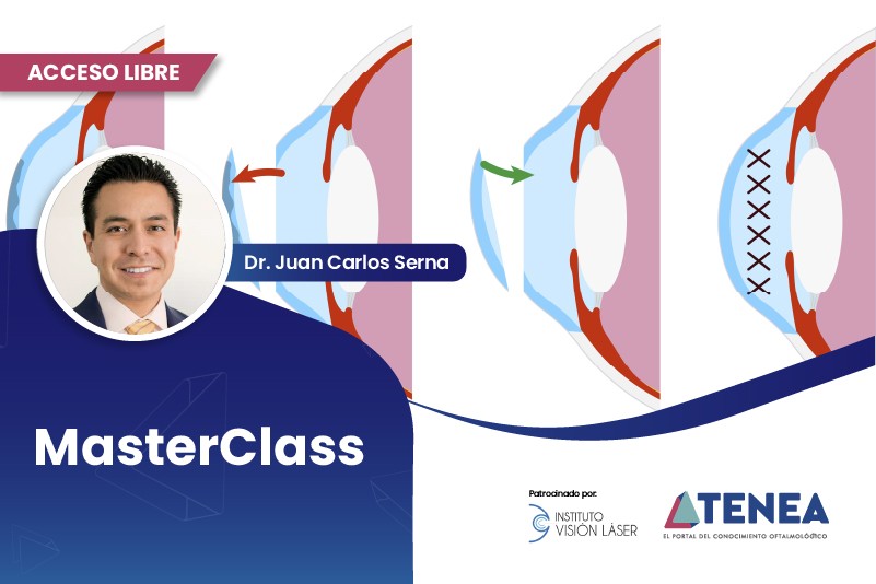 Manejo de urgencias en queratoplastia penetrante