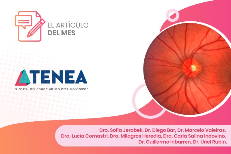 Retinopatía hipertensiva reporte de caso