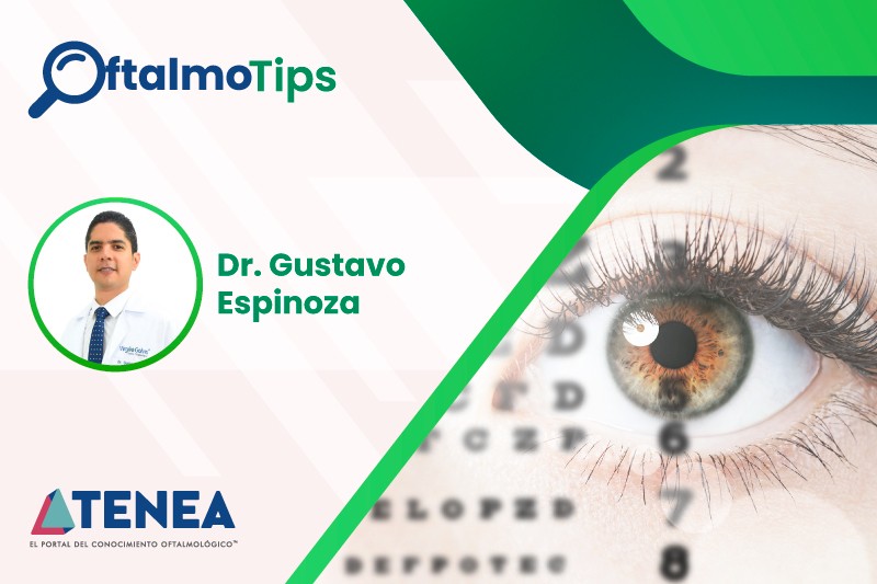 Tips en glaucoma para médicos generales