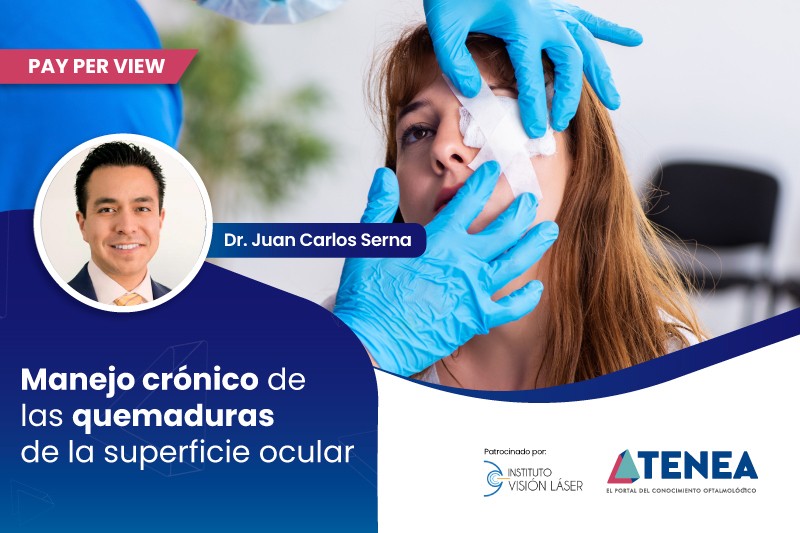Manejo crónico de las quemaduras de la superficie ocular