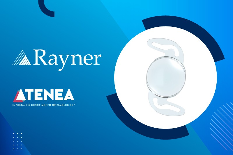 Implante de Lentes Intraoculares RayOne EMV: una perspectiva práctica