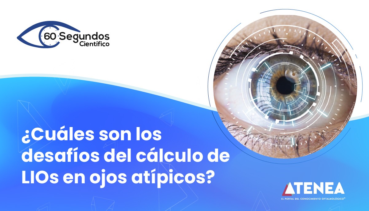 ¿Cuáles son los desafíos del cálculo de LIOs en ojos atípicos?