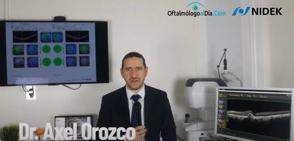 Protected: El Dr. Axel Orozco Hernández comparte su experiencia con el OCT RS-1 Glauvas de NIDEK.
