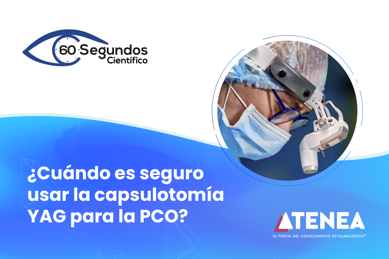Cuándo es seguro usar la capsulotomía YAG para la PCO