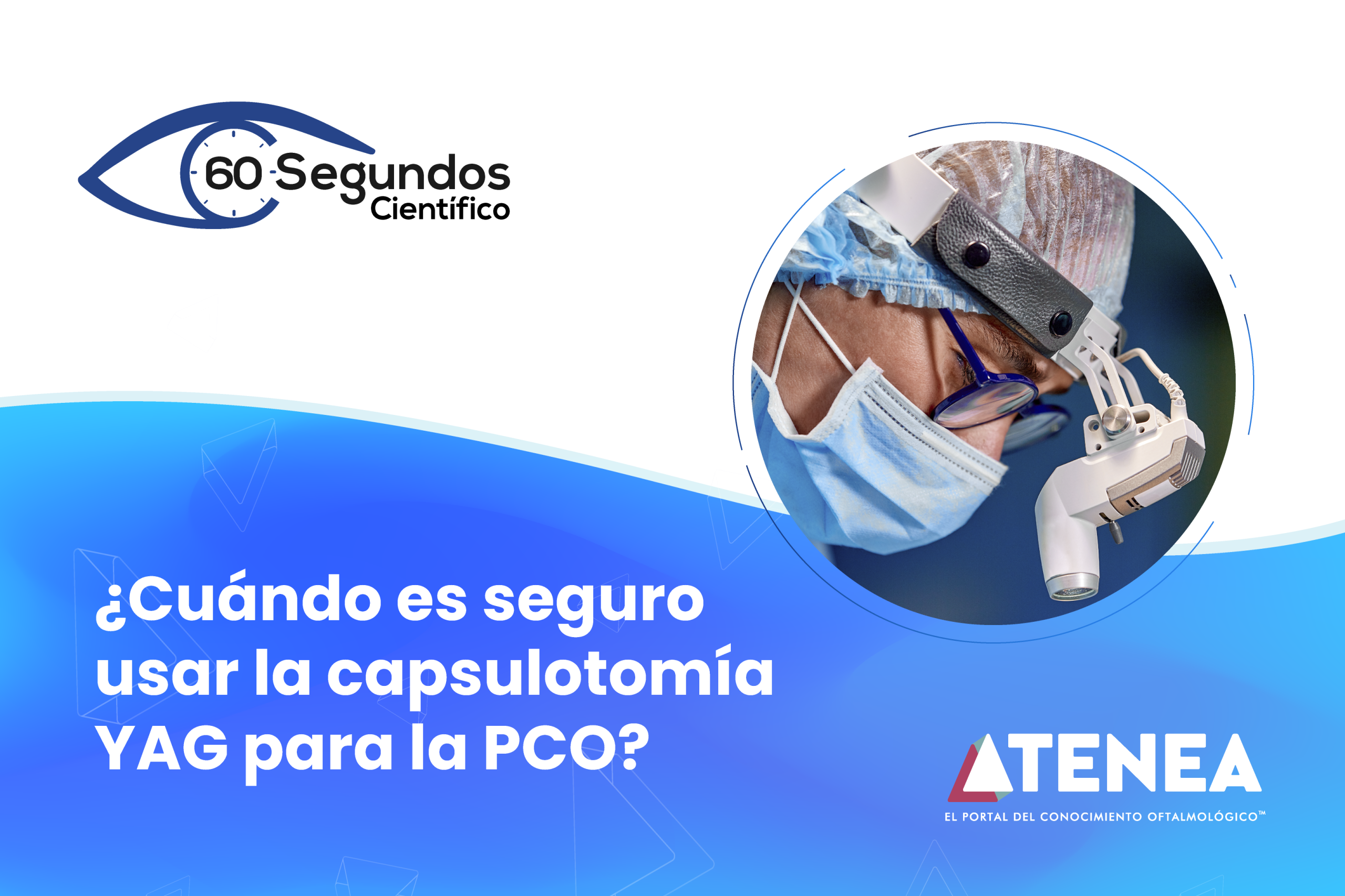 Cuándo es seguro usar la capsulotomía YAG para la PCO