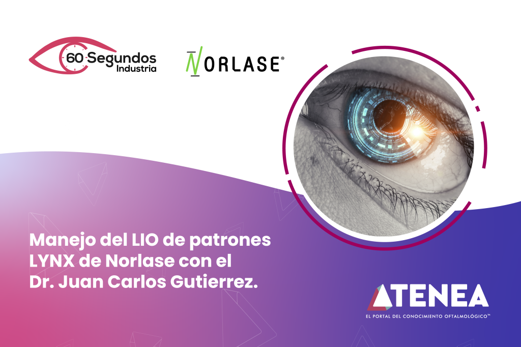 Manejo de LIO de patrones con el LYNX de Norlase.