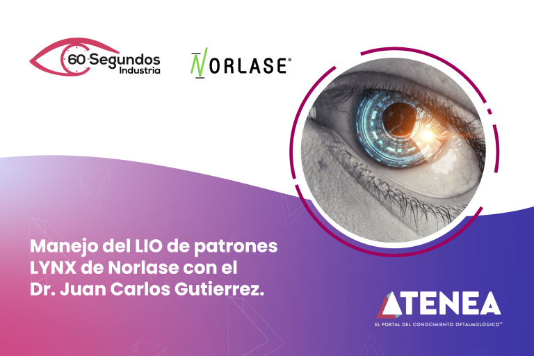 Manejo de LIO de patrones con el LYNX de Norlase.