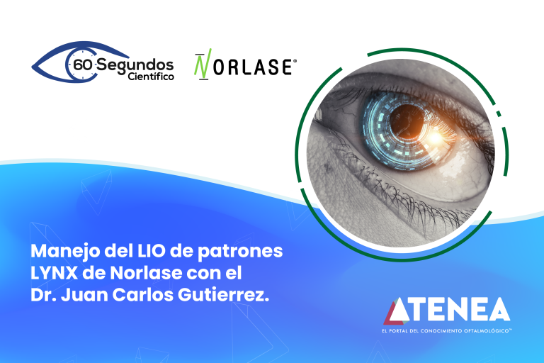Manejo de LIO de patrones con el LYNX de Norlase.
