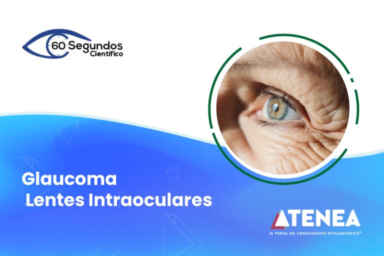 ¿Lentes premium en pacientes con glaucoma?