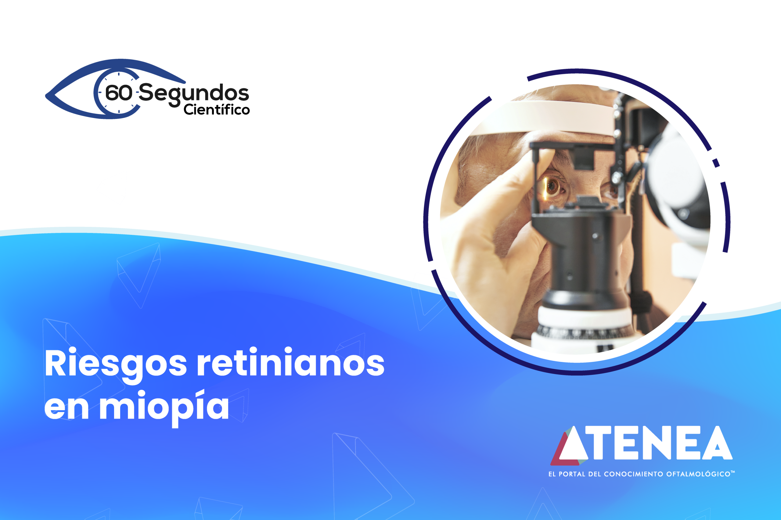 Riesgos retinianos en miopía