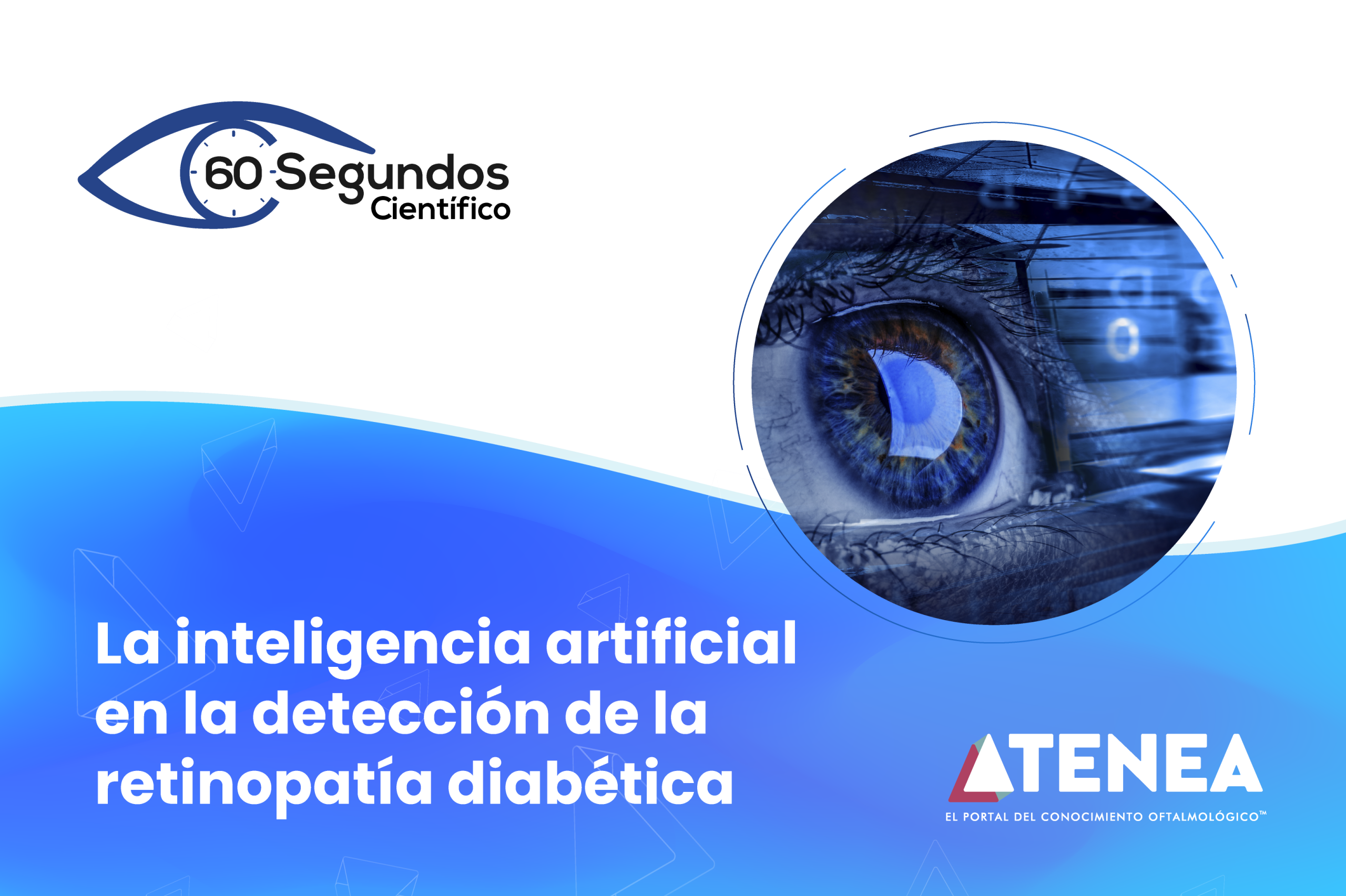 La inteligencia artificial en la detección de la retinopatía diabética